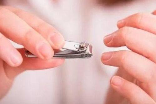 婆婆妈妈爆料灰指甲视频 第3张 婆婆妈妈爆料灰指甲视频 第3张